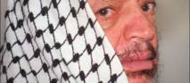 Israël-Palestine : qui avait intérêt à empoisonner Arafat ?