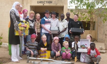 Les Albinos du Sénégal réclament une fabrique de crème solaire