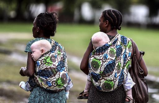 Tanzanie: le corps d'un bébé albinos enlevé retrouvé mutilé