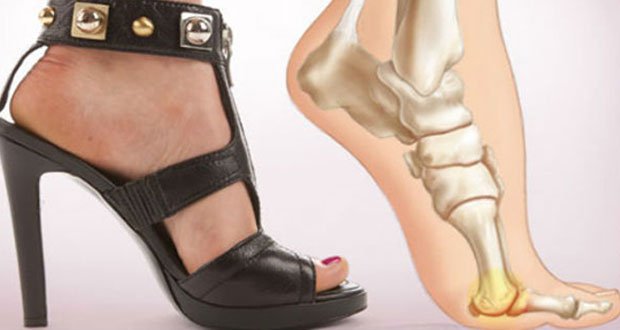 Les dangers des talons et comment ils affectent le corps