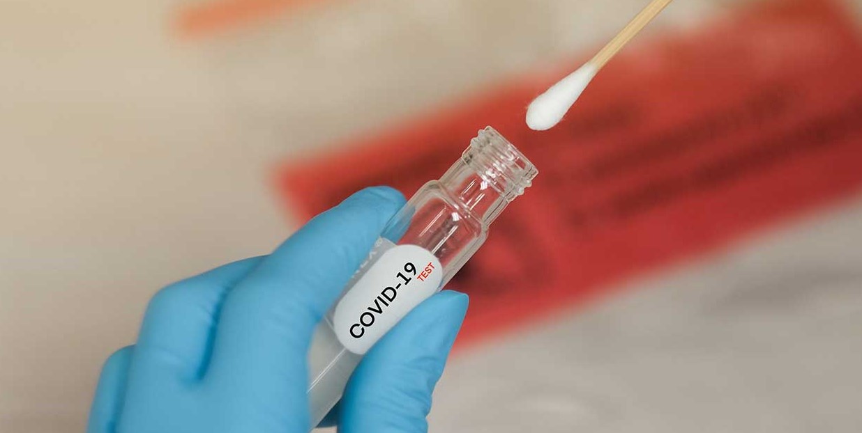 Coronavirus : « les prélèvements sur les pèlerins à l’AIBD font état de 78 cas positifs à la Covid-19 » ( MSAS )