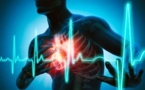 Au Sénégal, 30% des adultes sont hypertendus et 42% ont des malades cardiaques (Sosecar)